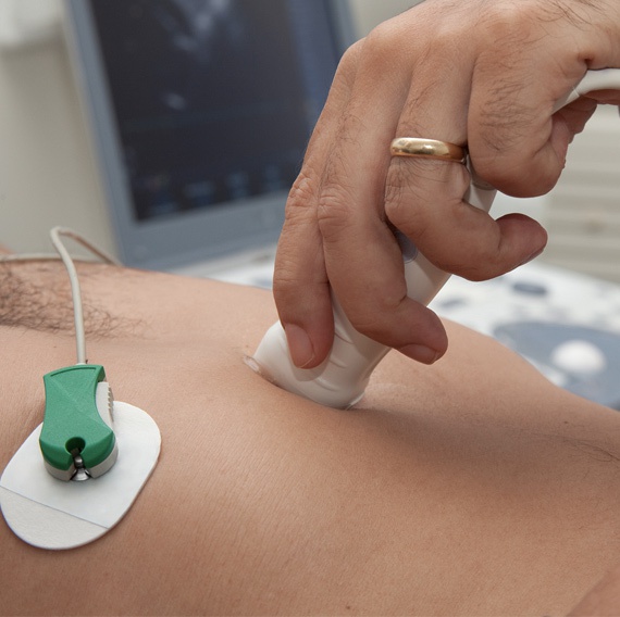 Ecodopplercardiograma transtorácico